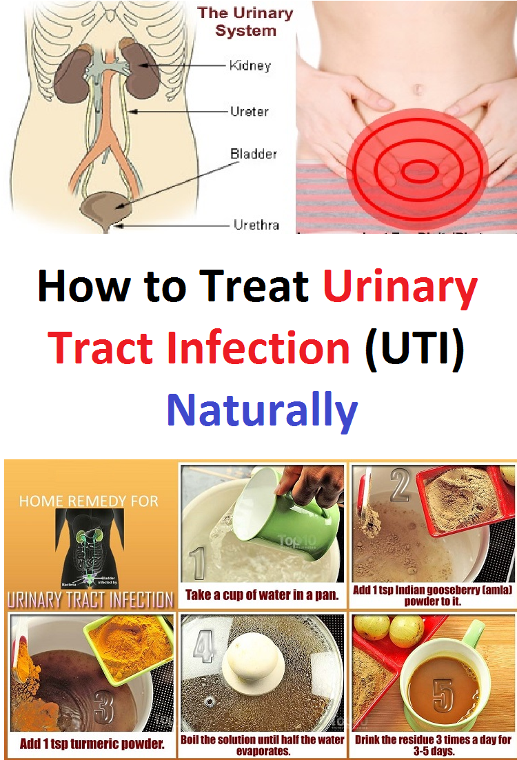How To Treat A Uti