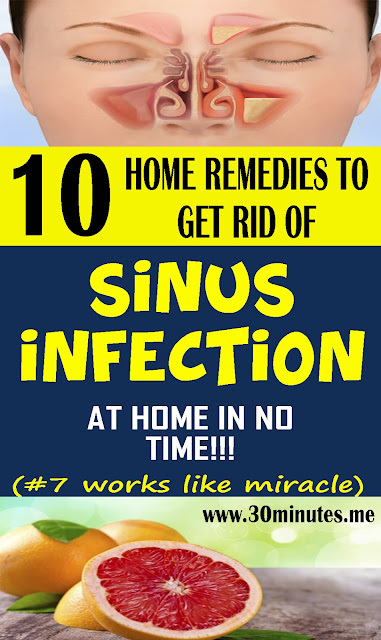 How To Treat Sinus Infection