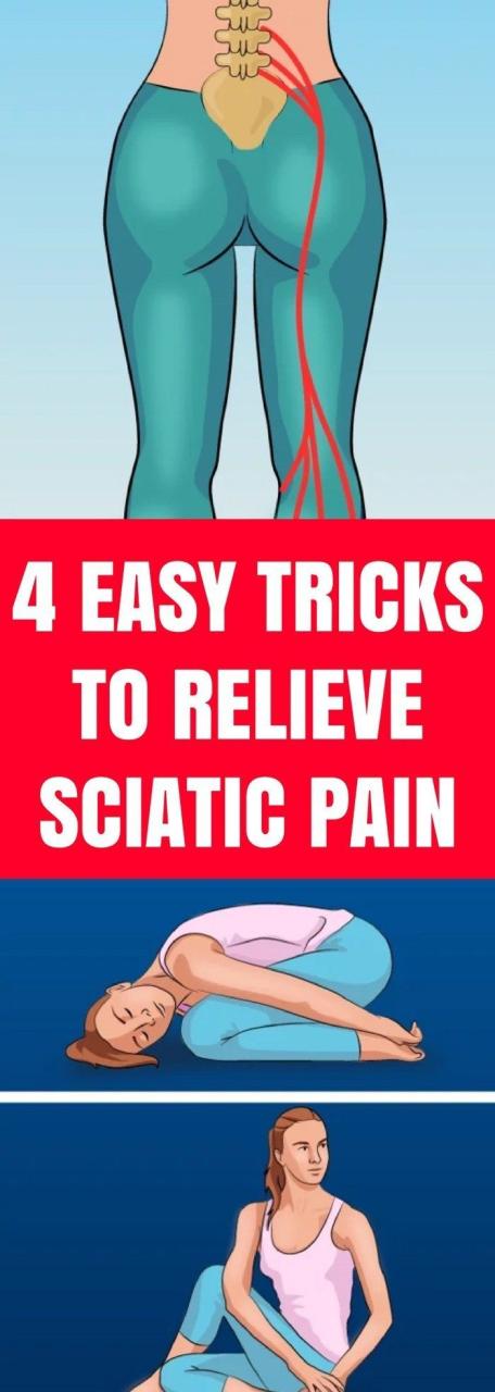 How To Relieve Sciatica Pain