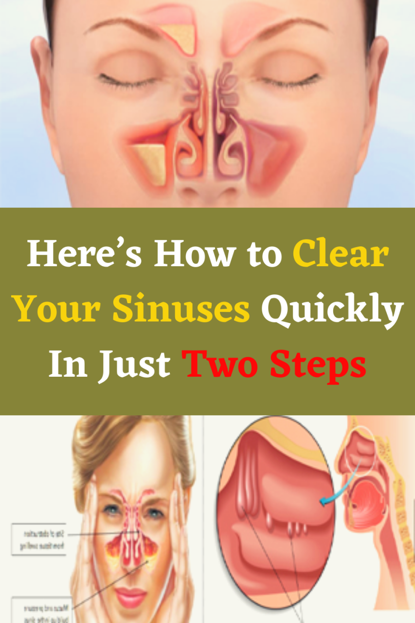 How To Clear Sinuses
