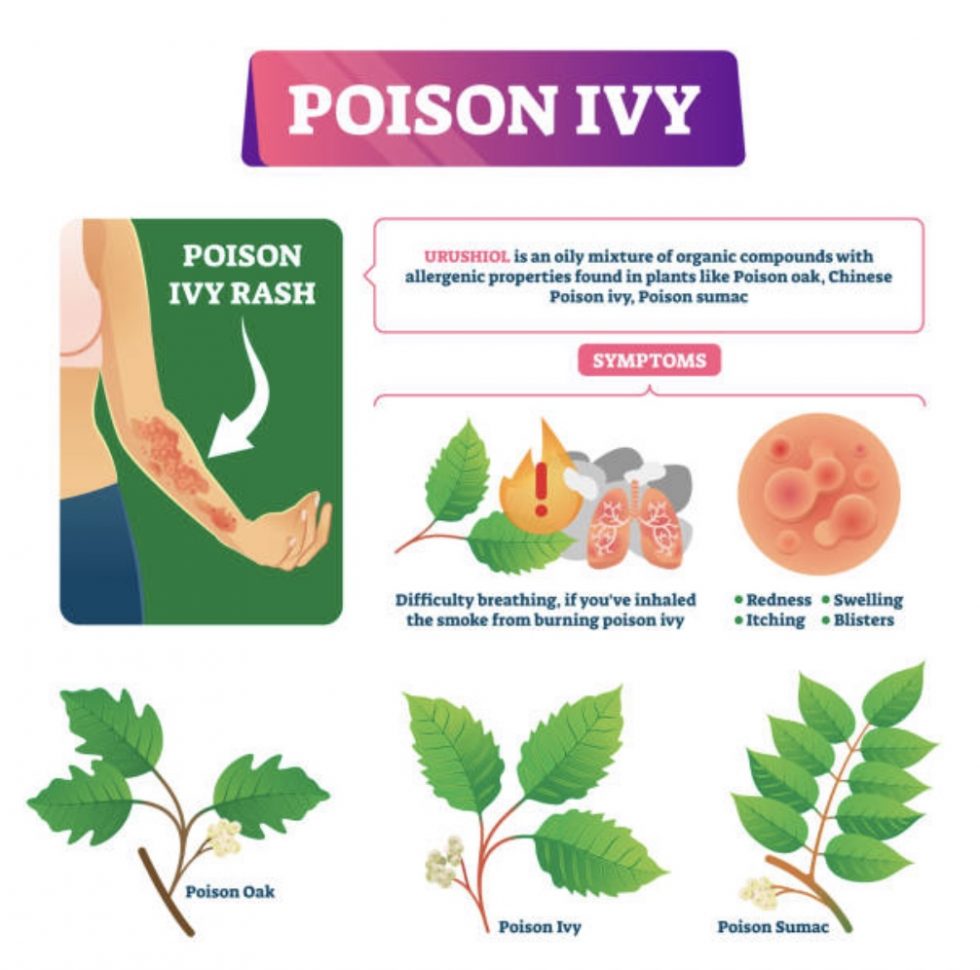 How To Treat Poison Ivy