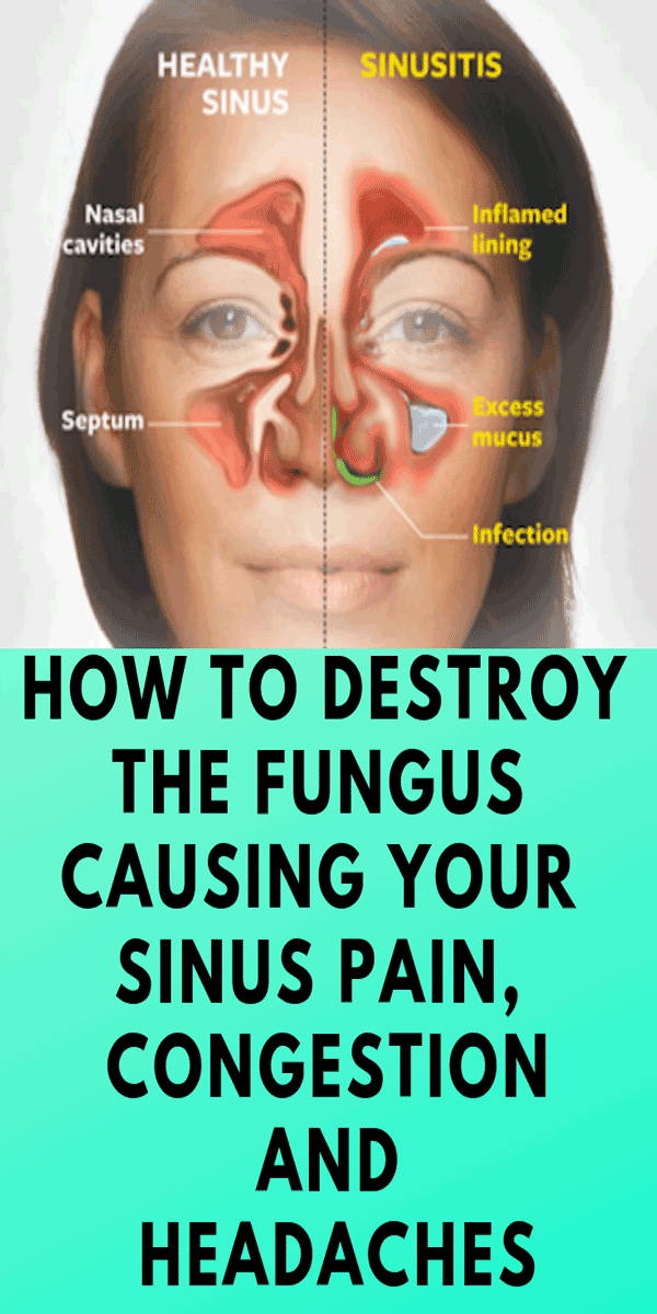 How To Drain Sinuses