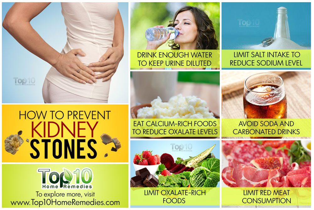 How To Prevent Kidney Stones