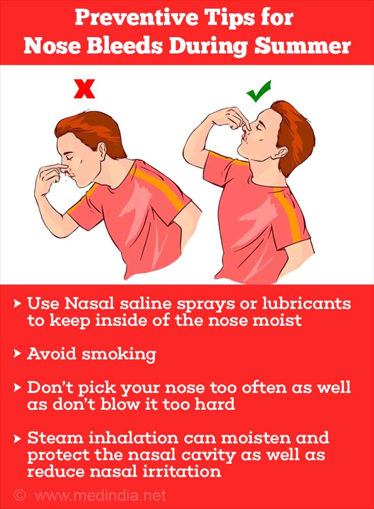 How To Stop Nose Bleeding