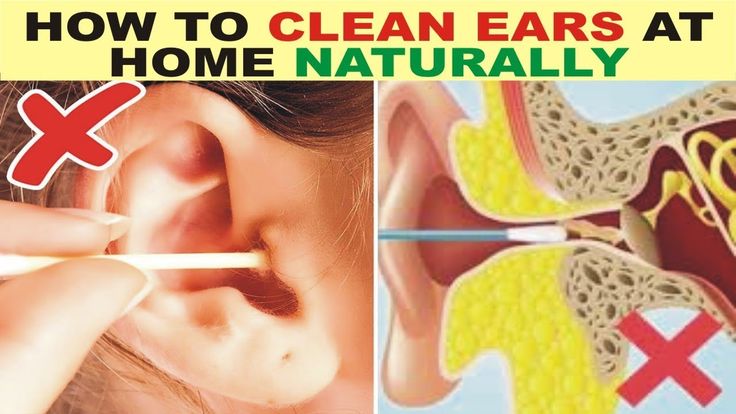 How To Properly Clean Ears