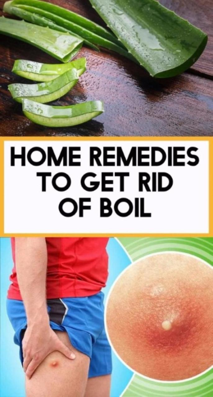 How To Treat A Boil