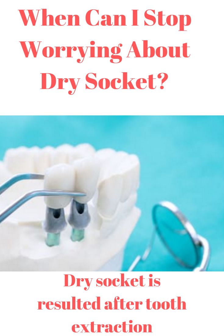 How To Treat Dry Socket