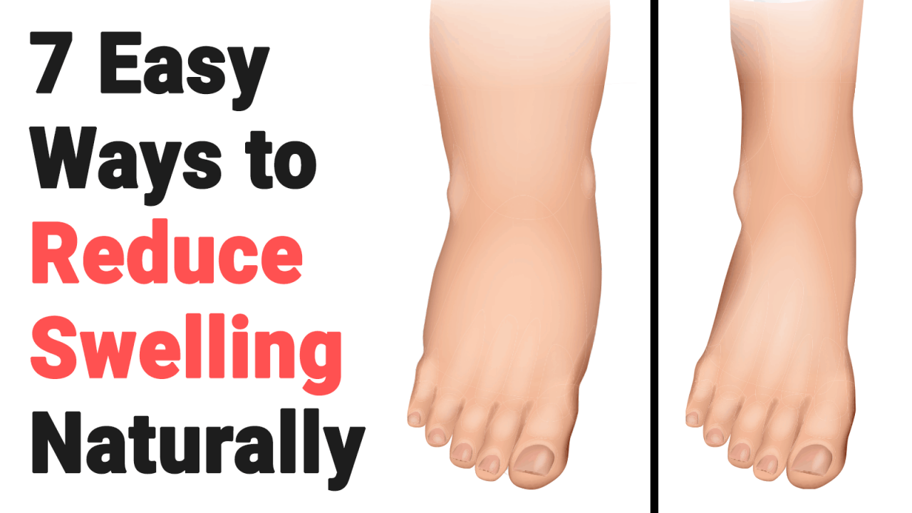 How To Reduce Swelling