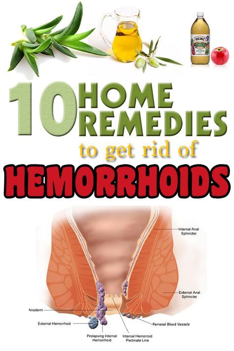 How To Cure Hemorrhoids