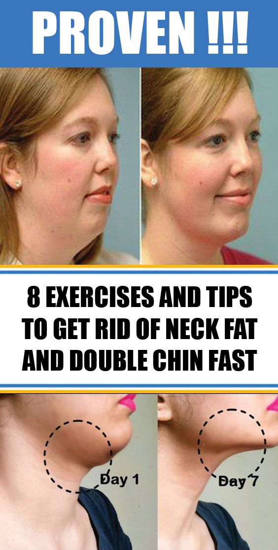 How To Lose Neck Fat