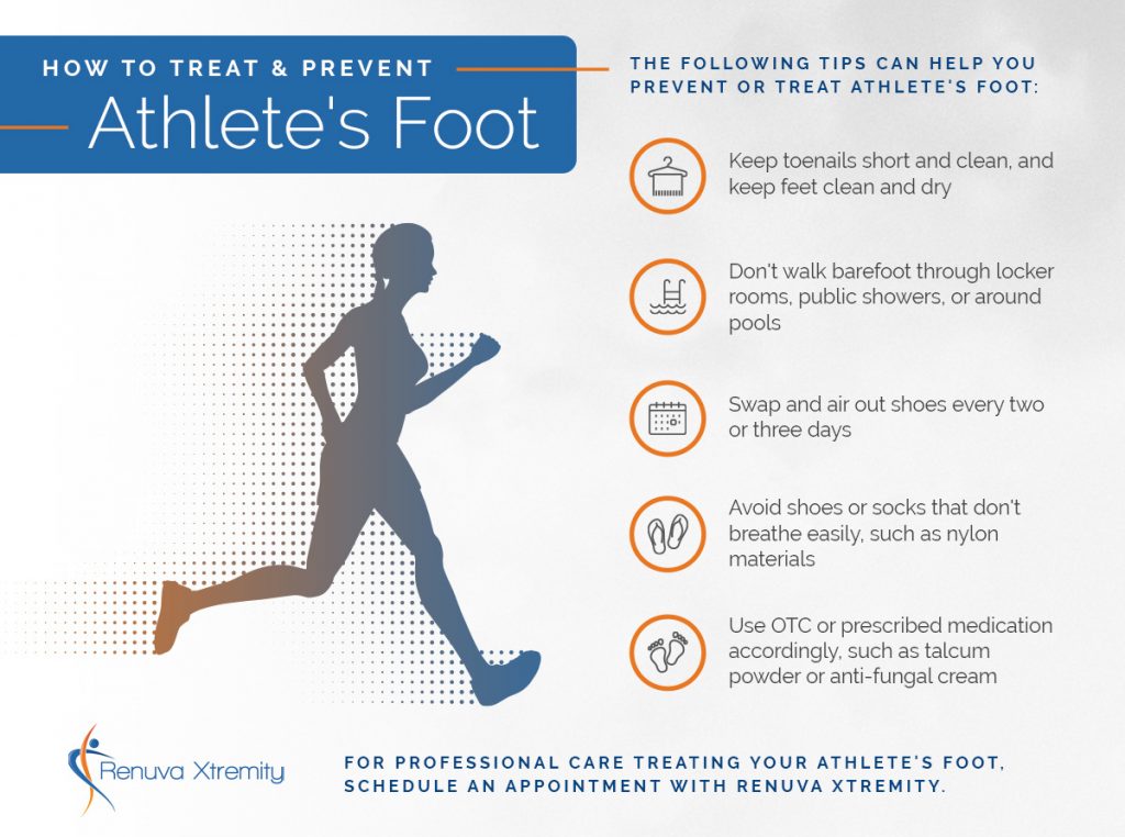 How To Treat Athlete's Foot