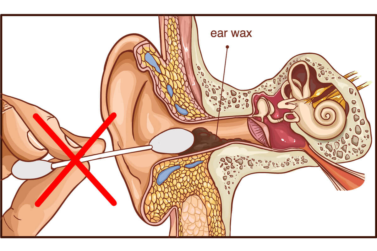 How To Clean Ear Wax