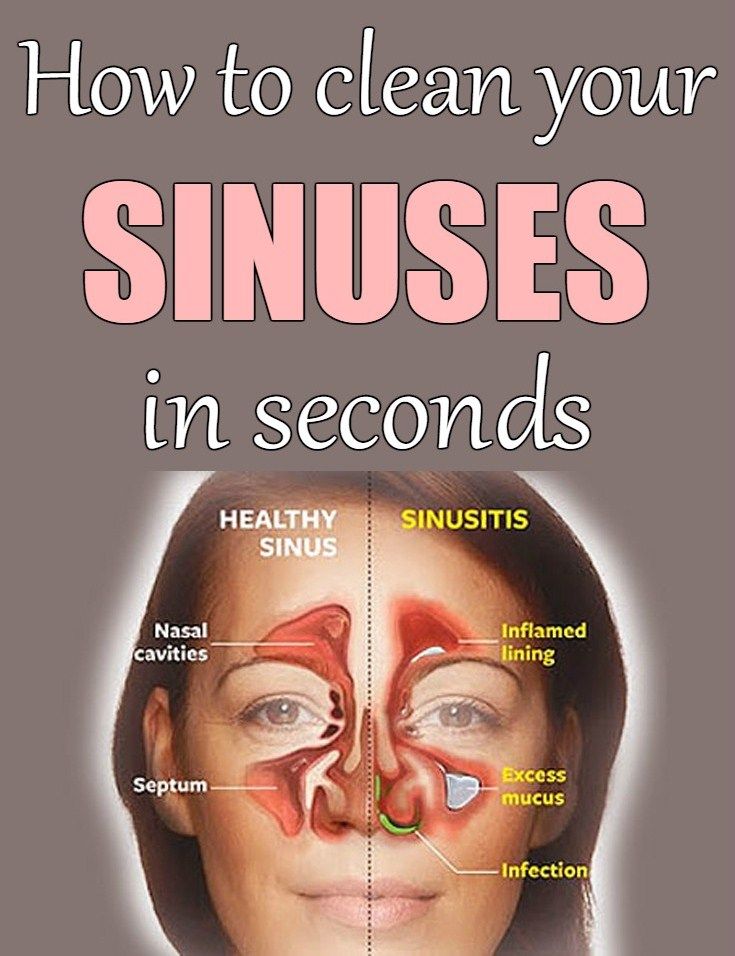 How To Cure Sinus Infection