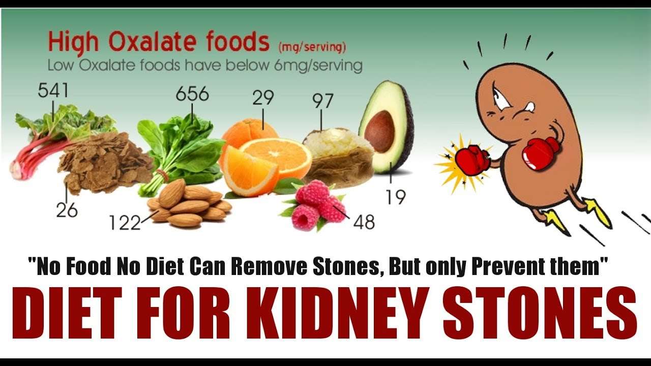 How To Avoid Kidney Stones