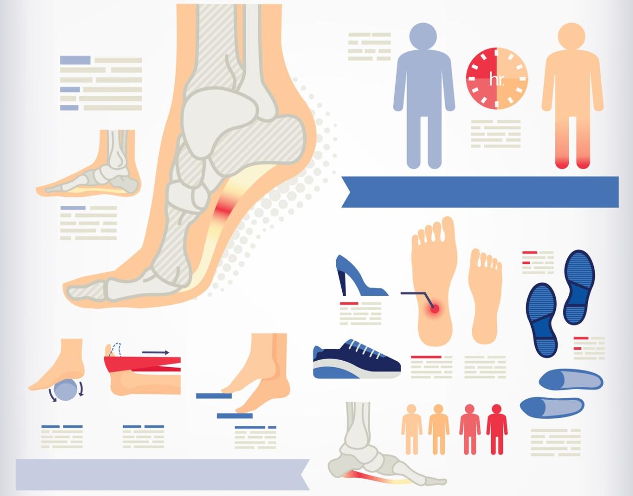 How To Treat Plantar Fasciitis