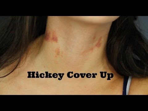 How To Cover A Hickey