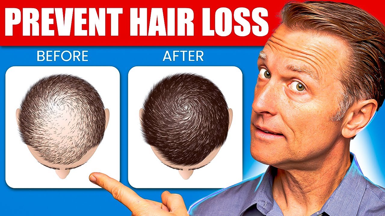 How To Prevent Hair Loss