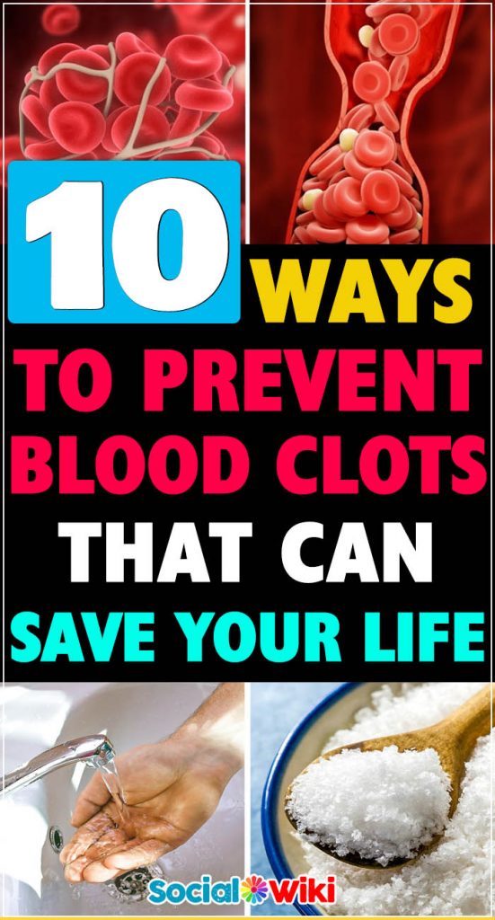 How To Prevent Blood Clots